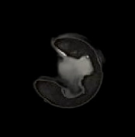 J100 M4 E Type Retaining Ring